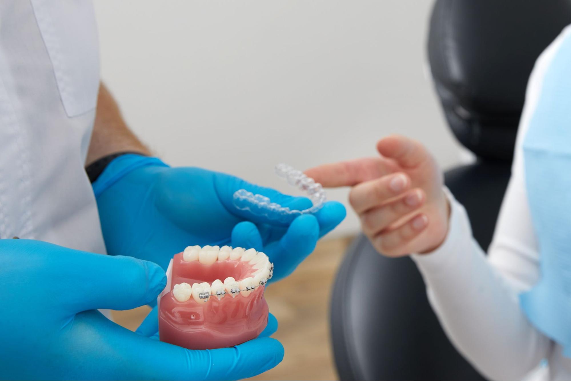 隱形牙套 跟傳統牙套的差異：4種牙套材質及優缺點介紹